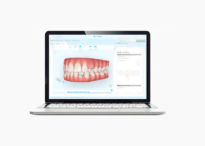 ３Dシュミレーションで 確認可能