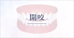 開咬