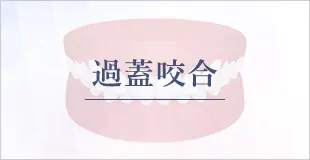 過蓋咬合