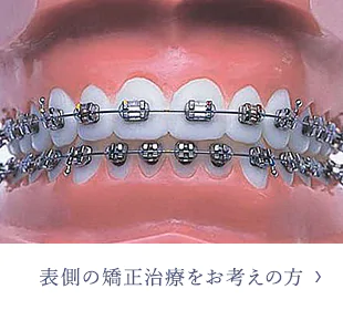 表側の矯正治療をお考えの方