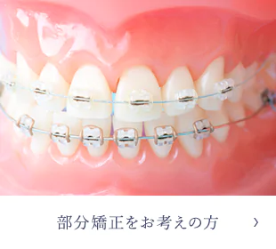 部分矯正をお考えの方