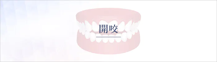 開咬