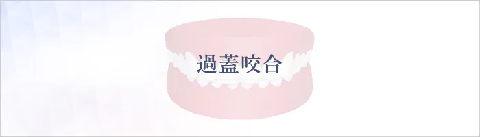 過蓋咬合