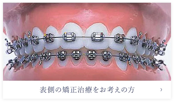 表側の矯正治療をお考えの方