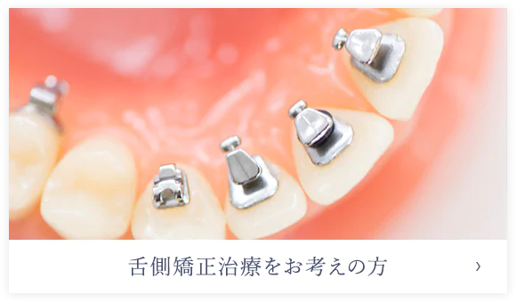 舌側矯正治療をお考えの方