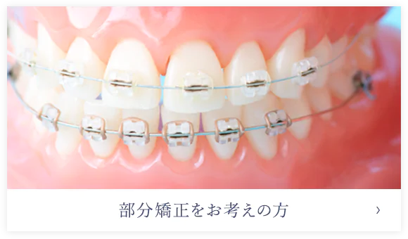 部分矯正をお考えの方